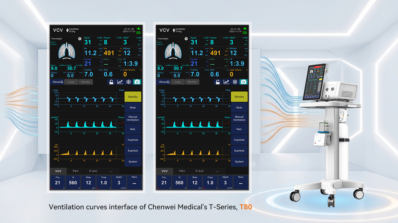 /ueditor/image/20260811/1786436602689821/b81a80727b3cb2dd8cd03968a1142ad1.jpg The Clinical and Financial Impact of Patient-Ventilator Asynchrony Toward a Comprehensive Solution in the Modern ICU-1.jpg