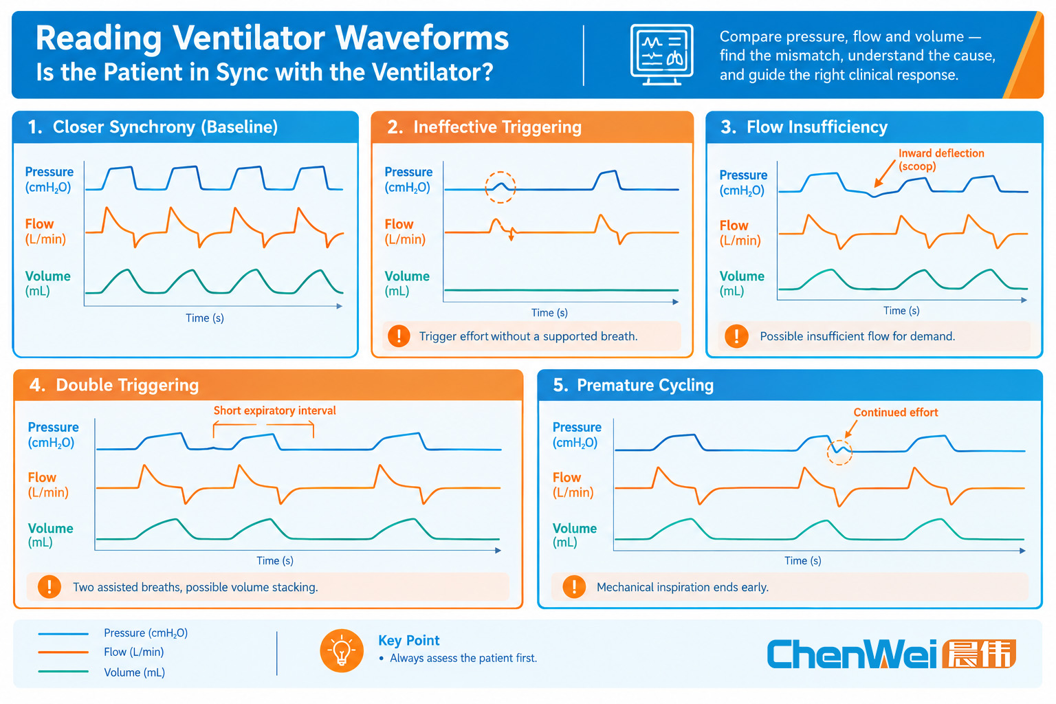 /ueditor/image/20260909/1788921430057618/baa687a1bc3d278a2d87b2b438afbd07.jpg 插图logo-Reading Ventilator Waveforms Is the Patient in Sync with the Ventilator-Chenwei Medical.jpg